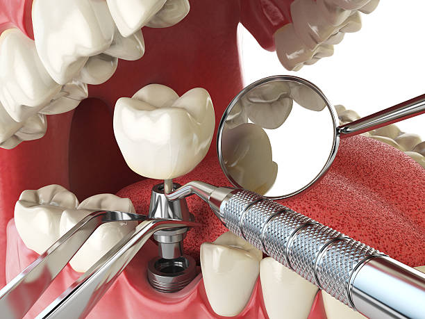 Best Emergency Dental Care for Broken or Chipped Teeth in Leisure Village West, NJ